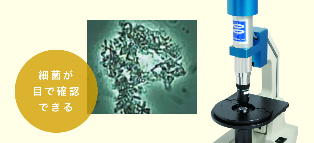 細菌が目で確認できる