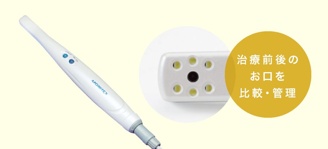 治療前後のお口を比較・管理