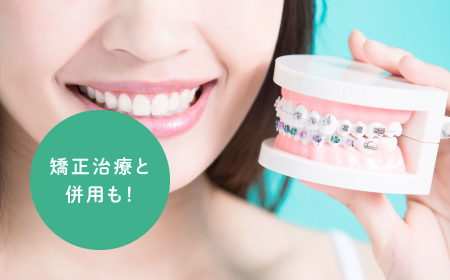 矯正治療と併用も！