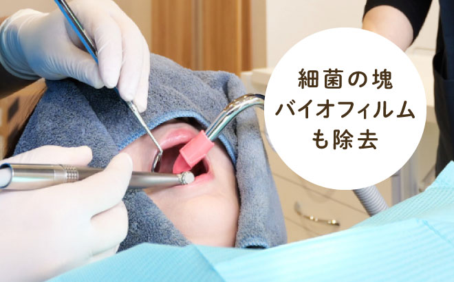 細菌の塊バイオフィルムも除去